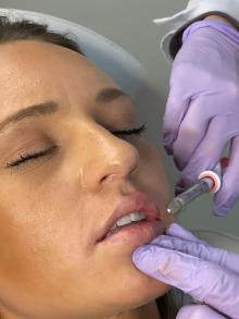 lip injections cost tulsa