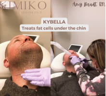Facial Firming & Fat Buster: Buy Kybella, Get 2 sessions of Evoke