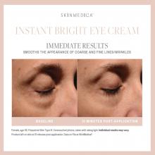 SkinMedica Instant Bright Eye Cream